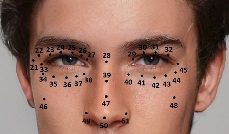 Tùy thuộc vào vị trí mà nốt ruồi trên khuôn mặt nam giới là lành hoặc dữ - hình 13