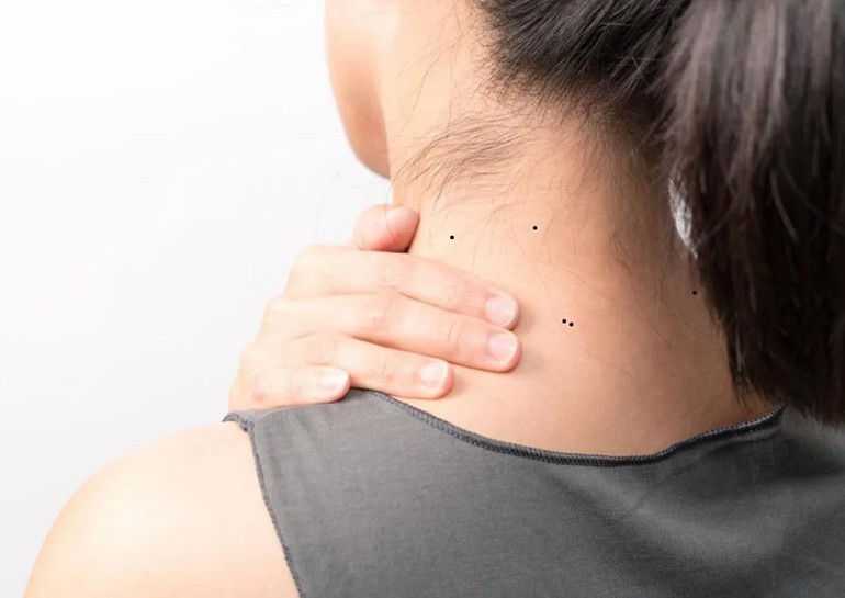 Nốt ruồi sau gáy bên trái phải của nam nữ giàu hay nghèo - Ảnh 14