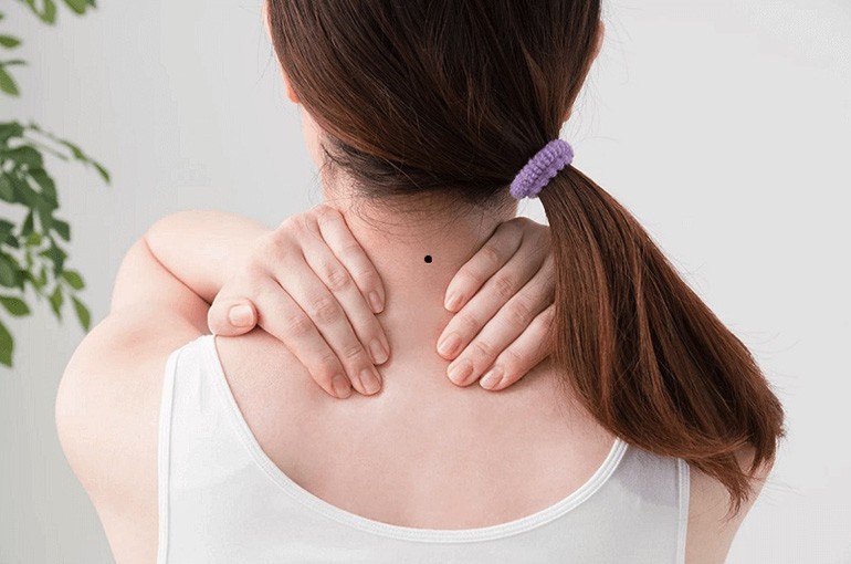 Nốt ruồi sau gáy bên trái phải của nam nữ giàu hay nghèo - Ảnh 15