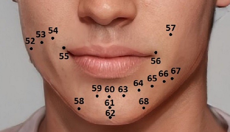 Nốt ruồi ở gần miệng và cằm nam giới - hình 17