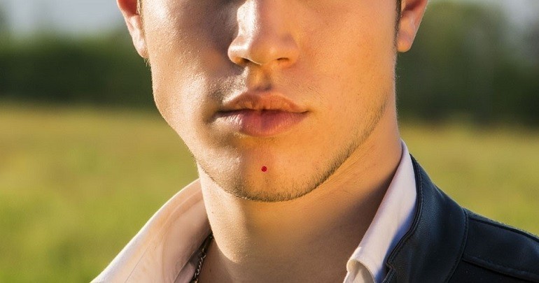 Nốt ruồi son mang tài lộc cho nam giới - hình 18