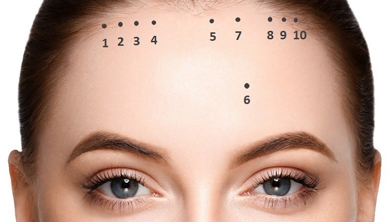 Ý nghĩa vị trí nốt ruồi trên mặt nam, nữ nói lên tình, tiền - hình 2