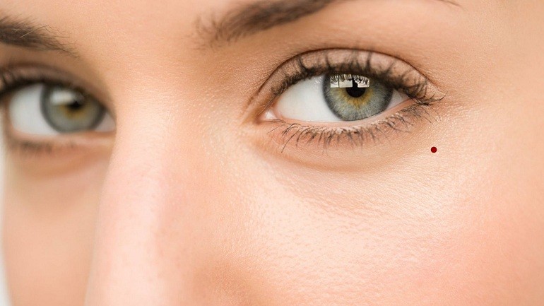 Dưới mắt có nốt ruồi tùy thuộc vào trái, phải, nam nữ mà có ý nghĩa khác nhau - hình 21