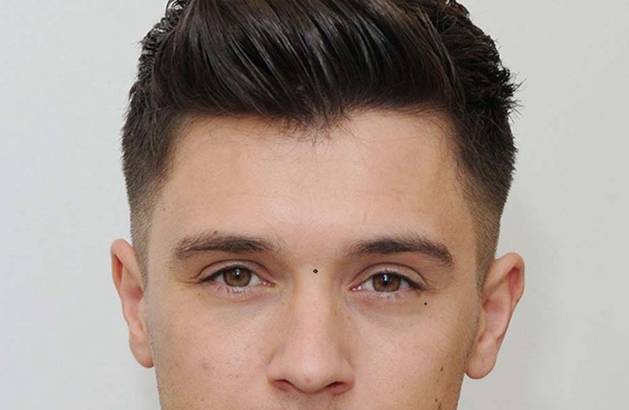 Nam giới cũng có những nốt ruồi tốt trên mặt - hình 21