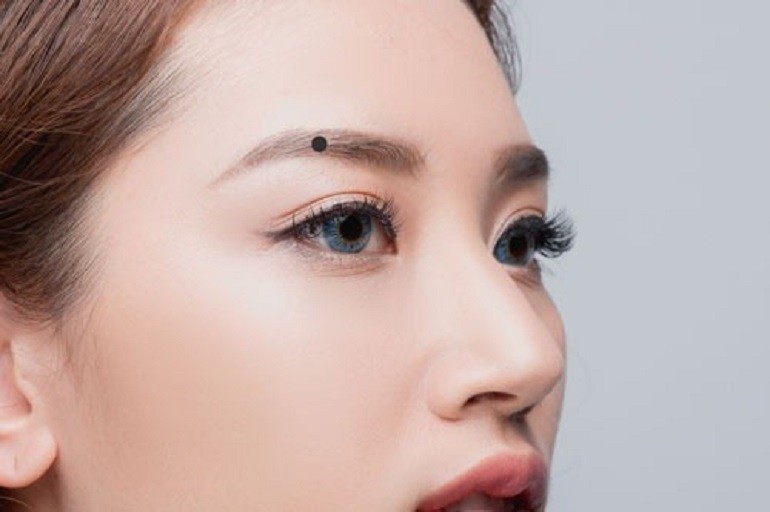 Nốt ruồi ở giữa lông mày có ý nghĩa gì? - hình 22