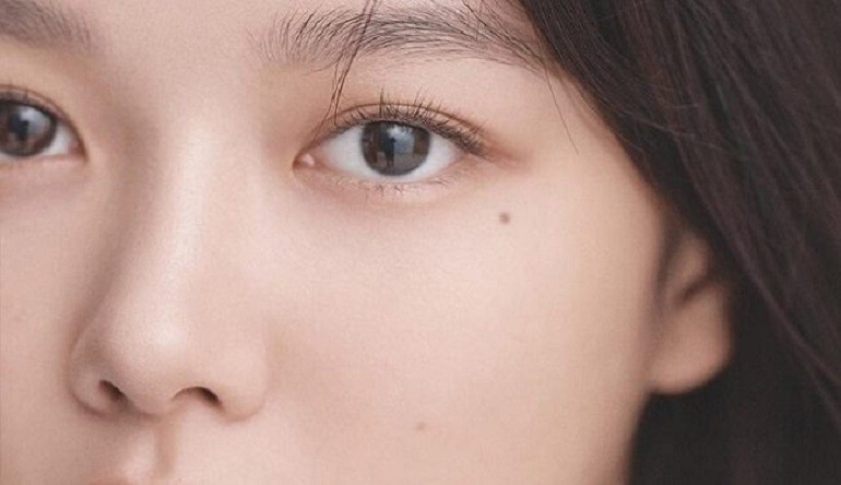 Nốt ruồi ở dưới mắt thường là người đa sầu, đa cảm - hình 23