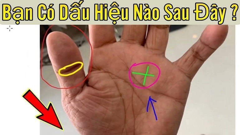 Người có bàn tay chữ X mờ thường được cho là dễ đối mặt với những khó khăn và trắc trở về mọi mặt của cuộc sống - Ảnh 28