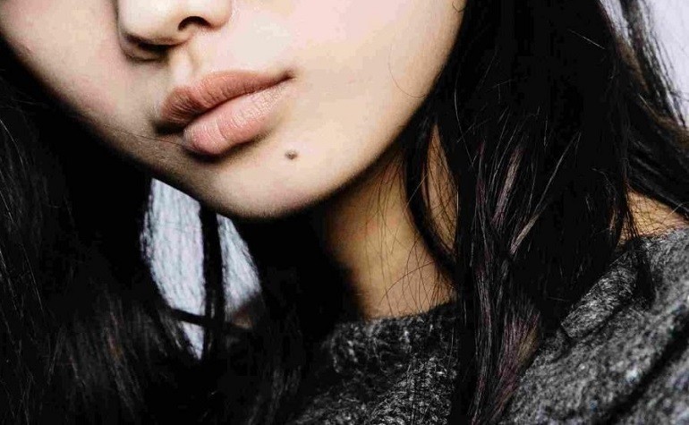 Nốt ruồi dưới cằm được xem là khá may mắn - hình 29