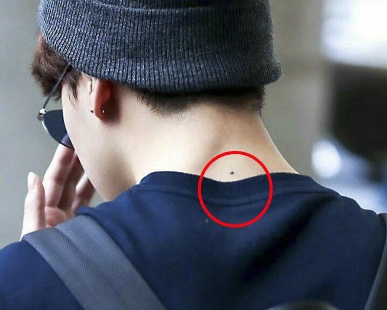 Nốt ruồi sau gáy bên trái phải của nam nữ giàu hay nghèo - Ảnh 3
