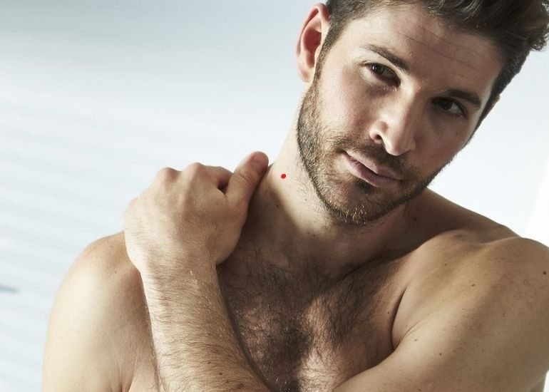 Nốt ruồi son là gì, nốt ruồi son ở đâu là may mắn, giàu có? - hình 3