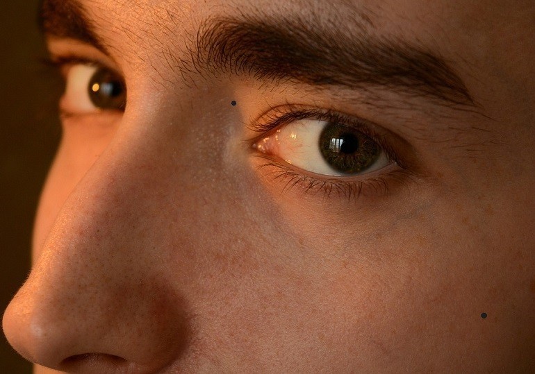 Nam giới cũng sở hữu những nốt ruồi mang những ý nghĩa khác nhau - hình 9