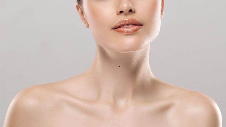 Nốt ruồi ở giữa cổ không tốt theo nhân tướng học - Ảnh 5