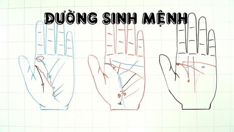 Đường sinh đạo ngắn hoặc đường sinh mệnh bị đứt là những đặc điểm không nên có - Ảnh 14